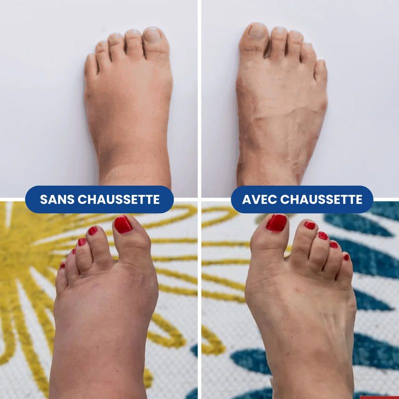 Avant / Après gonflement